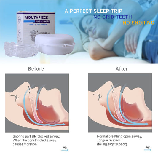 Anti-Snoring Mouth Guard for Bruxism and Sleep Apnea